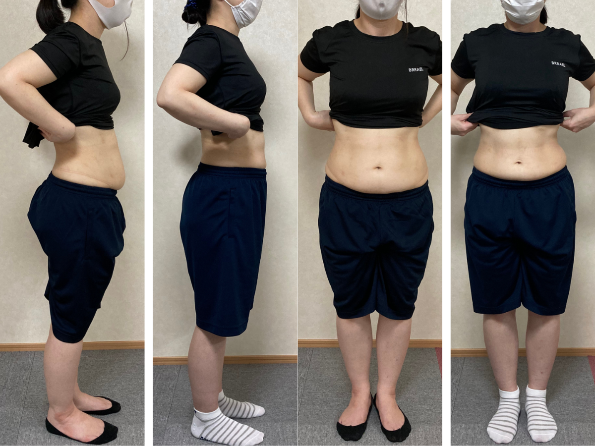 TさんのBefore After