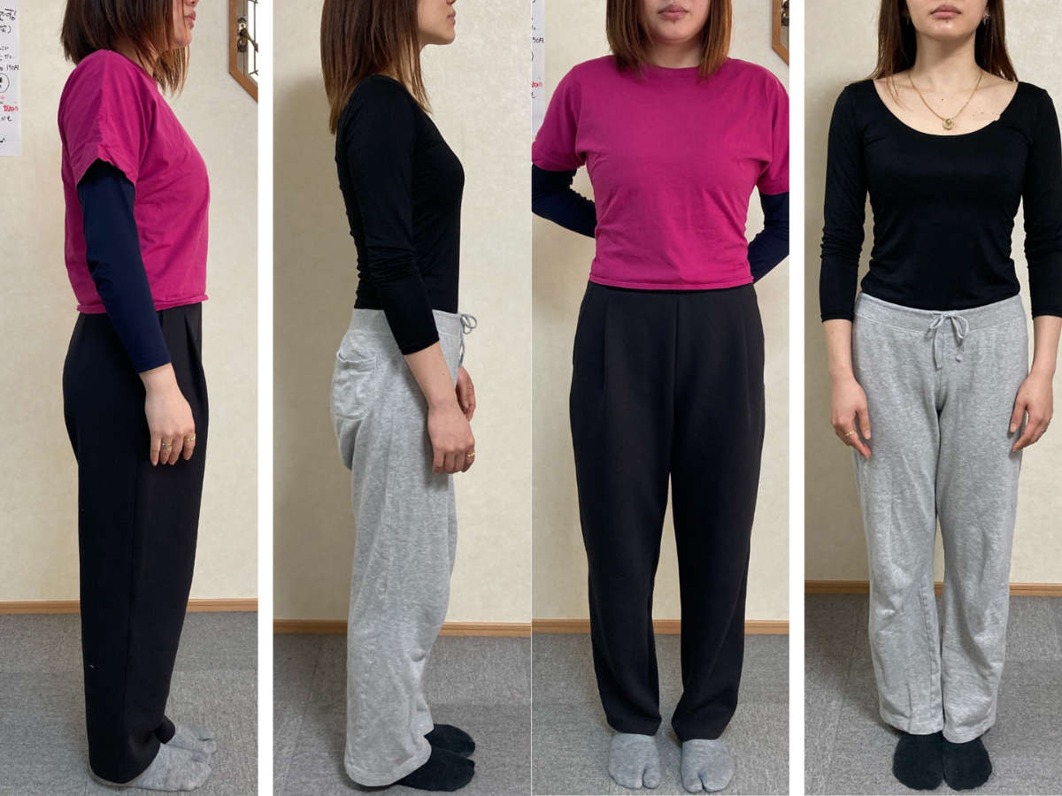 上村さんのBefore After